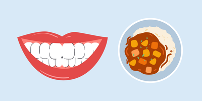 does curry stain teeth 