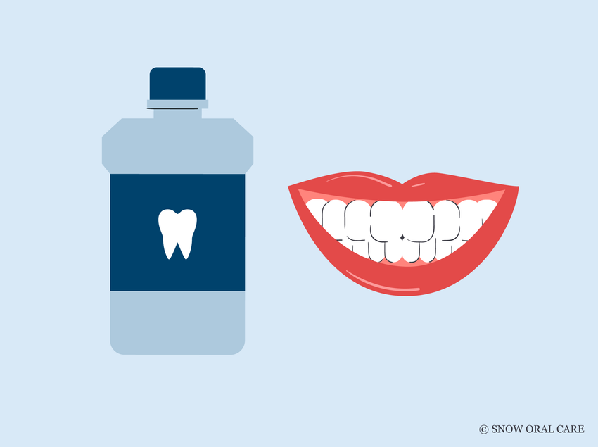 does fluoride stain teeth