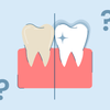 Does Fluoride Whiten Teeth? Here's Everything You Need to Know