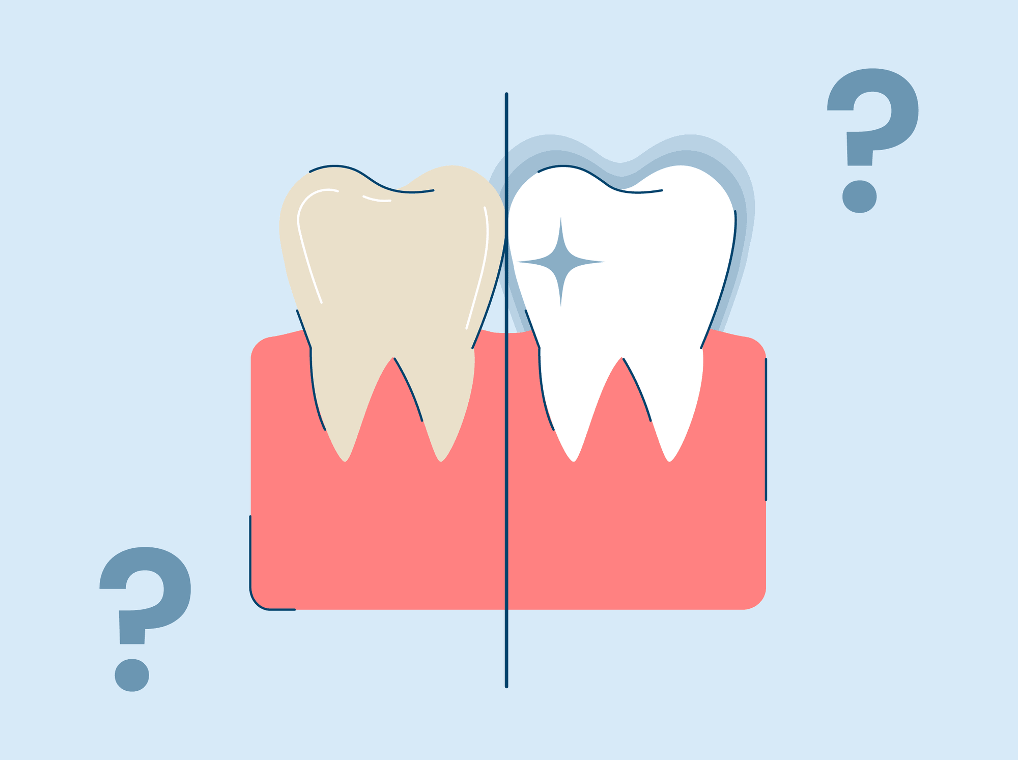 Does Fluoride Whiten Teeth? Here's Everything You Need to Know