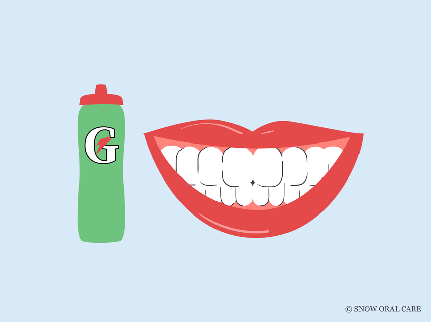 does gatorade stain teeth 