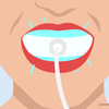 does led teeth whitening work 
