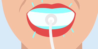 does led teeth whitening work 