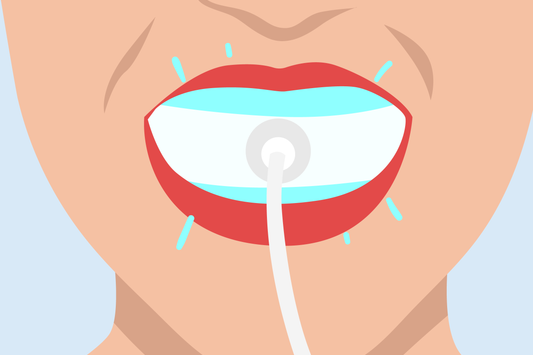 does led teeth whitening work 