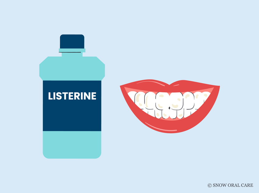 does listerine stain teeth