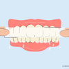 does saliva ruin teeth whitening strips