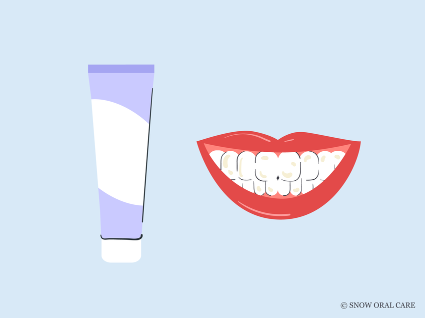 does stannous fluoride stain teeth