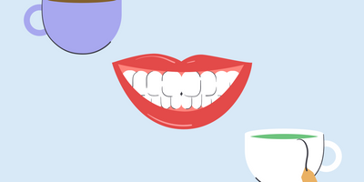 does tea stain your teeth 