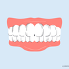 does teeth whitening damage enamel 