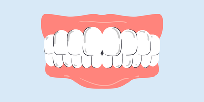 does teeth whitening damage enamel 