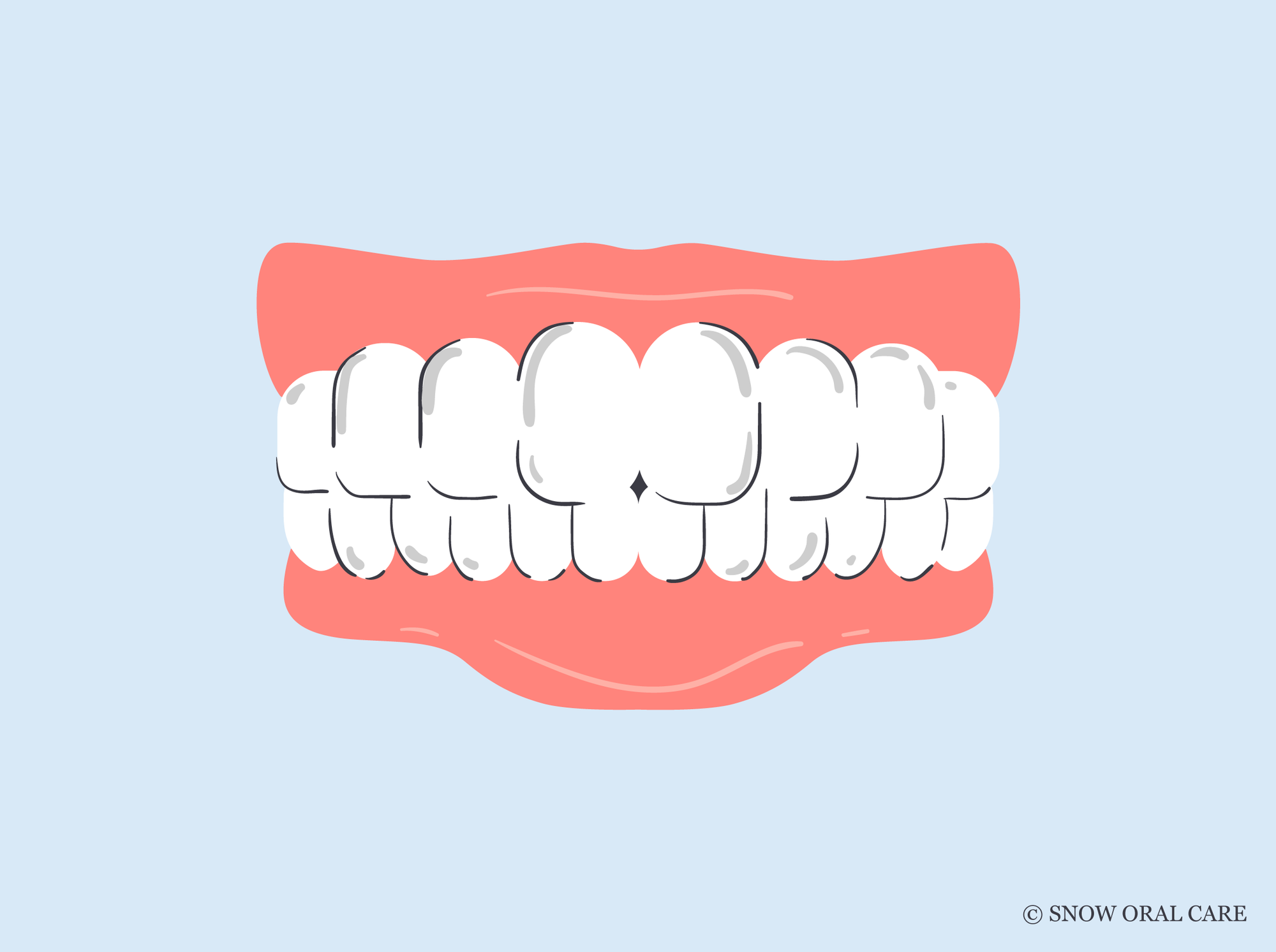 does teeth whitening damage enamel 