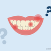 does teeth whitening hurt 