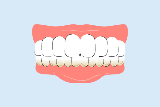 does teeth whitening remove plaque 