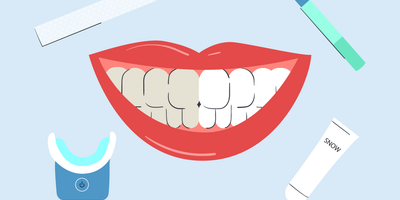 does teeth whitening work 