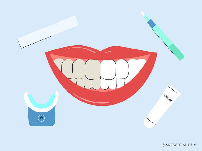 does teeth whitening work 