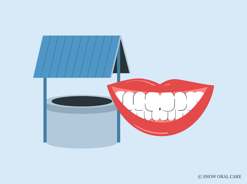 does well water make your teeth yellow 