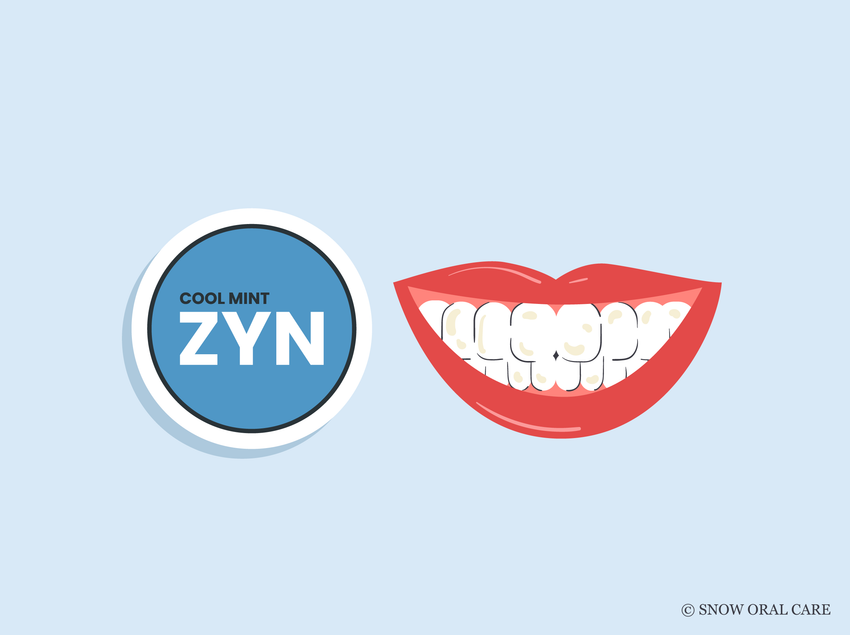 does zyn stain teeth