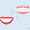 electric toothbrush side effects