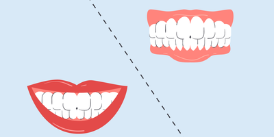 electric toothbrush side effects