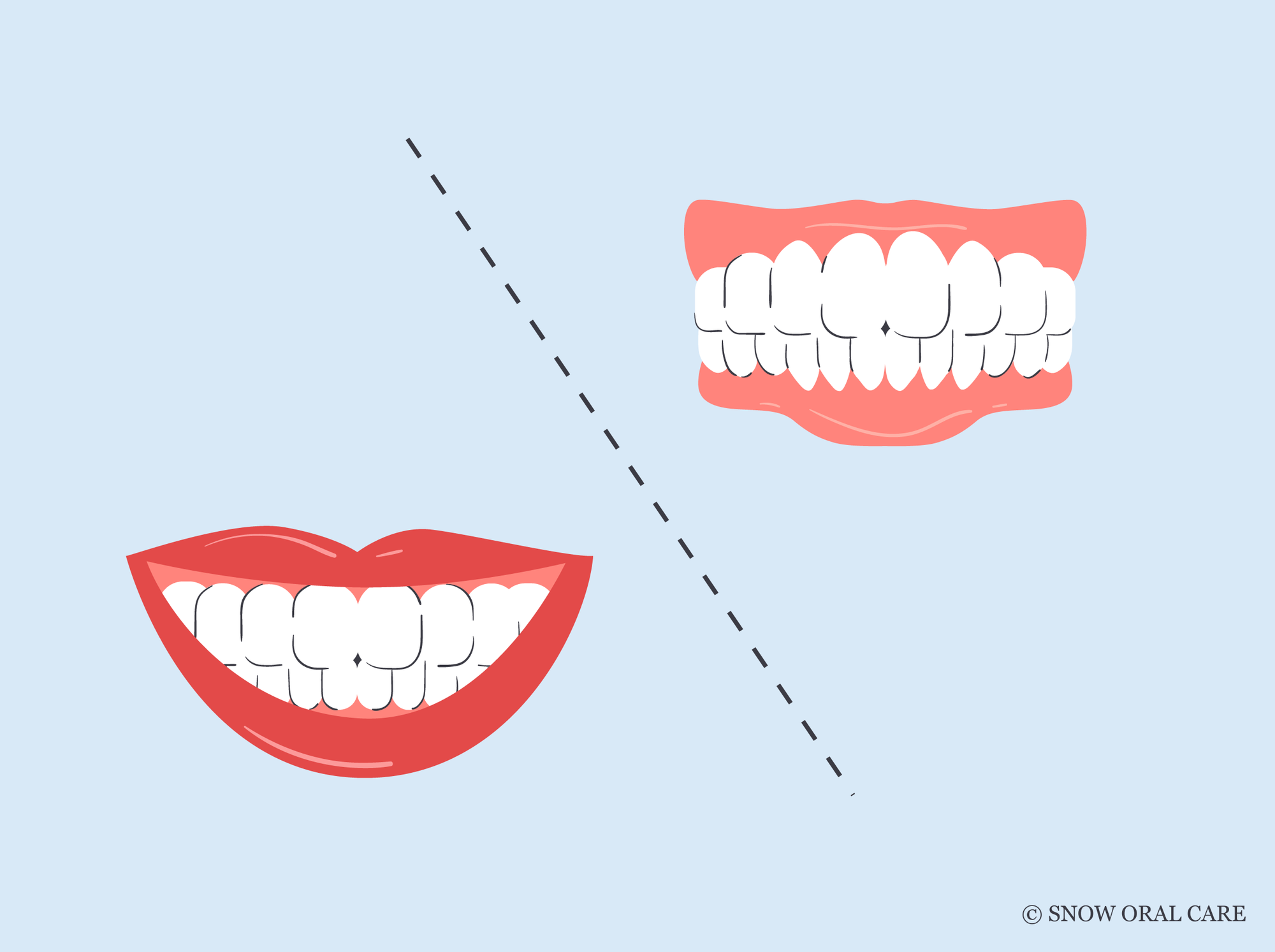electric toothbrush side effects