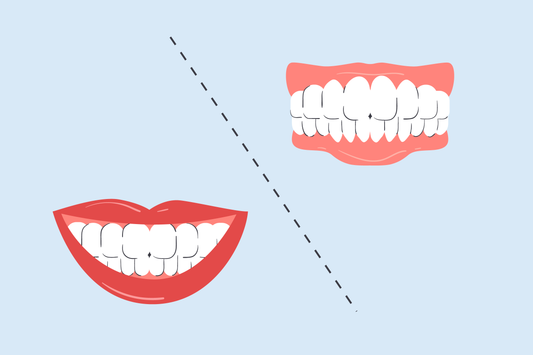 electric toothbrush side effects