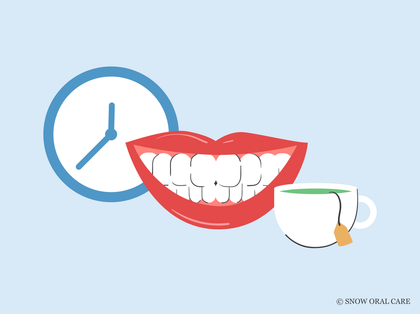 how long after home teeth whitening can i drink tea 