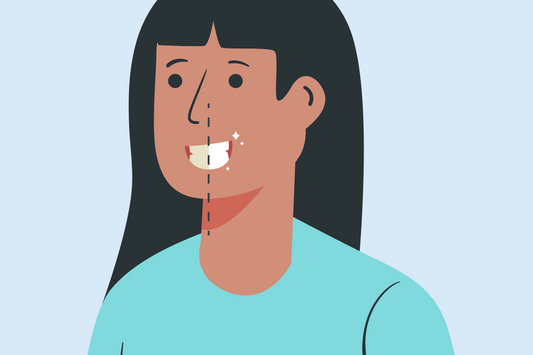 how long are teeth porous after whitening 
