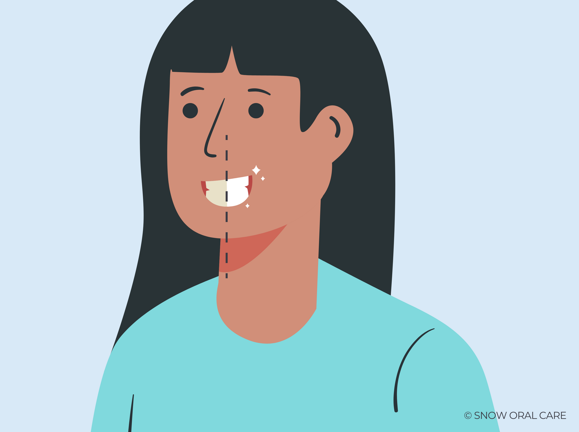 how long are teeth porous after whitening 