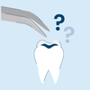 How Long Do Fillings Last?