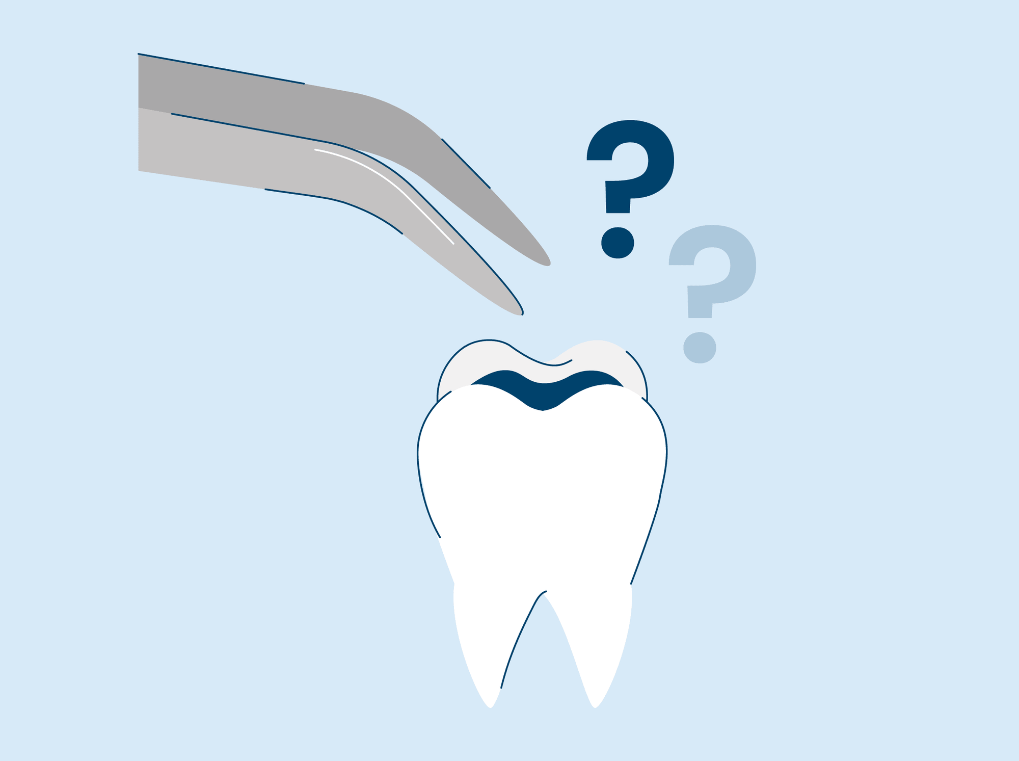 How Long Do Fillings Last?