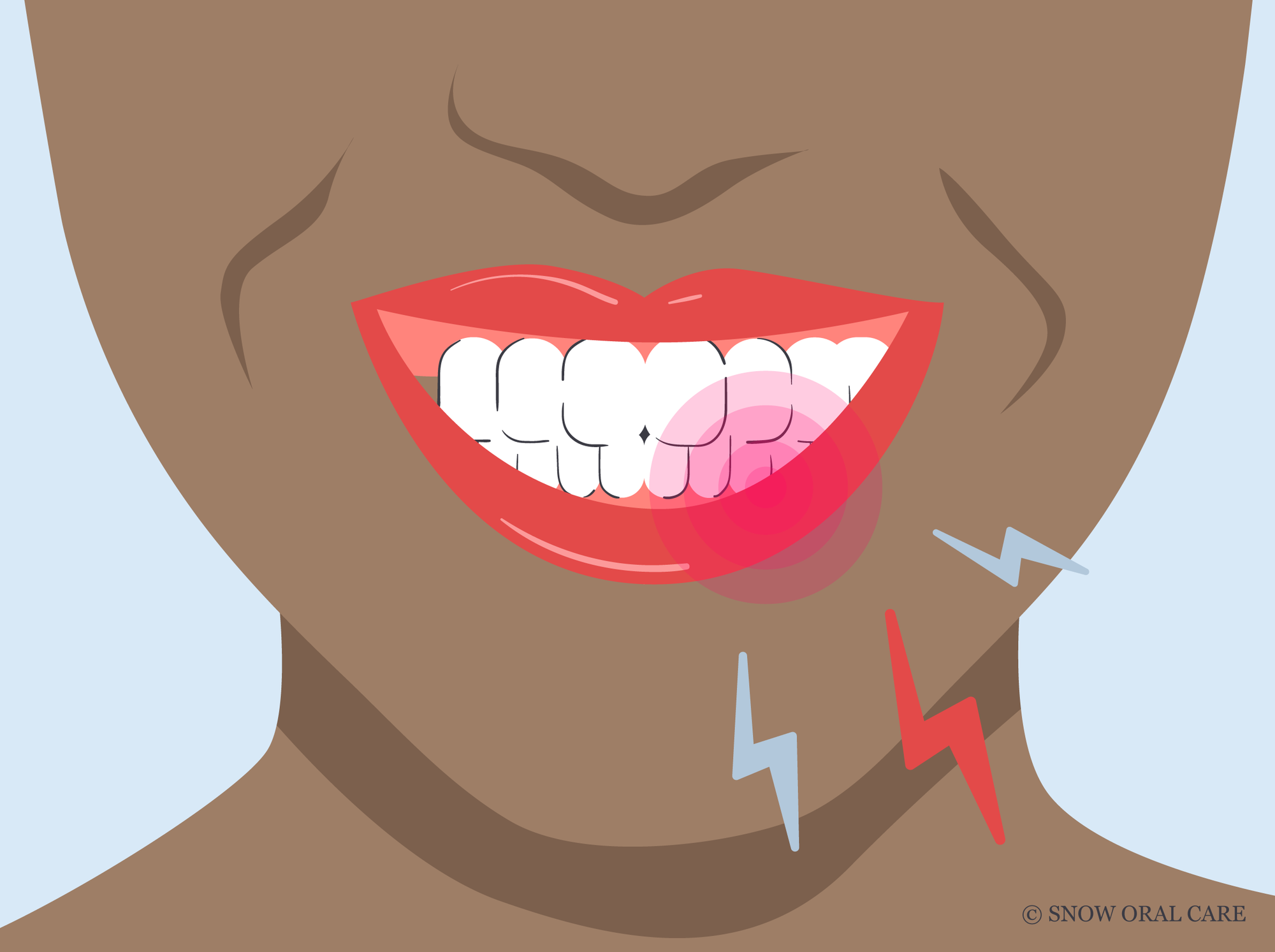 how long do zingers last after teeth whitening 
