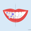 how long does it take for purple toothpaste to work