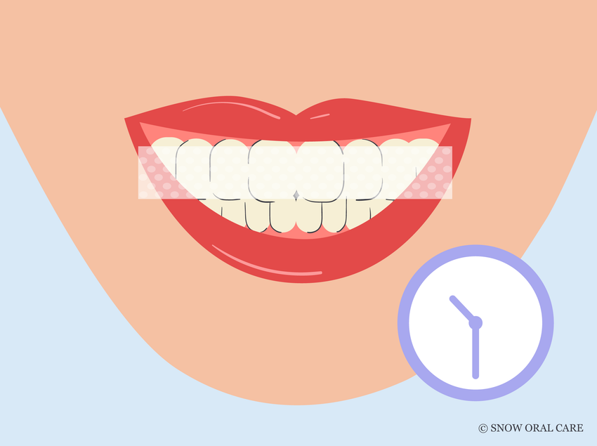 how long to leave teeth whitening strips on 