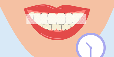 how long to leave teeth whitening strips on 
