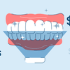 How Much Does Professional Teeth Whitening Cost?