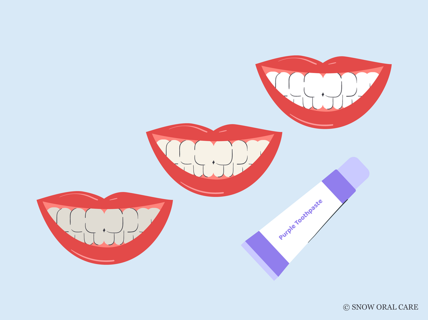 how often should you use purple toothpaste