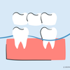 how to floss a bridge
