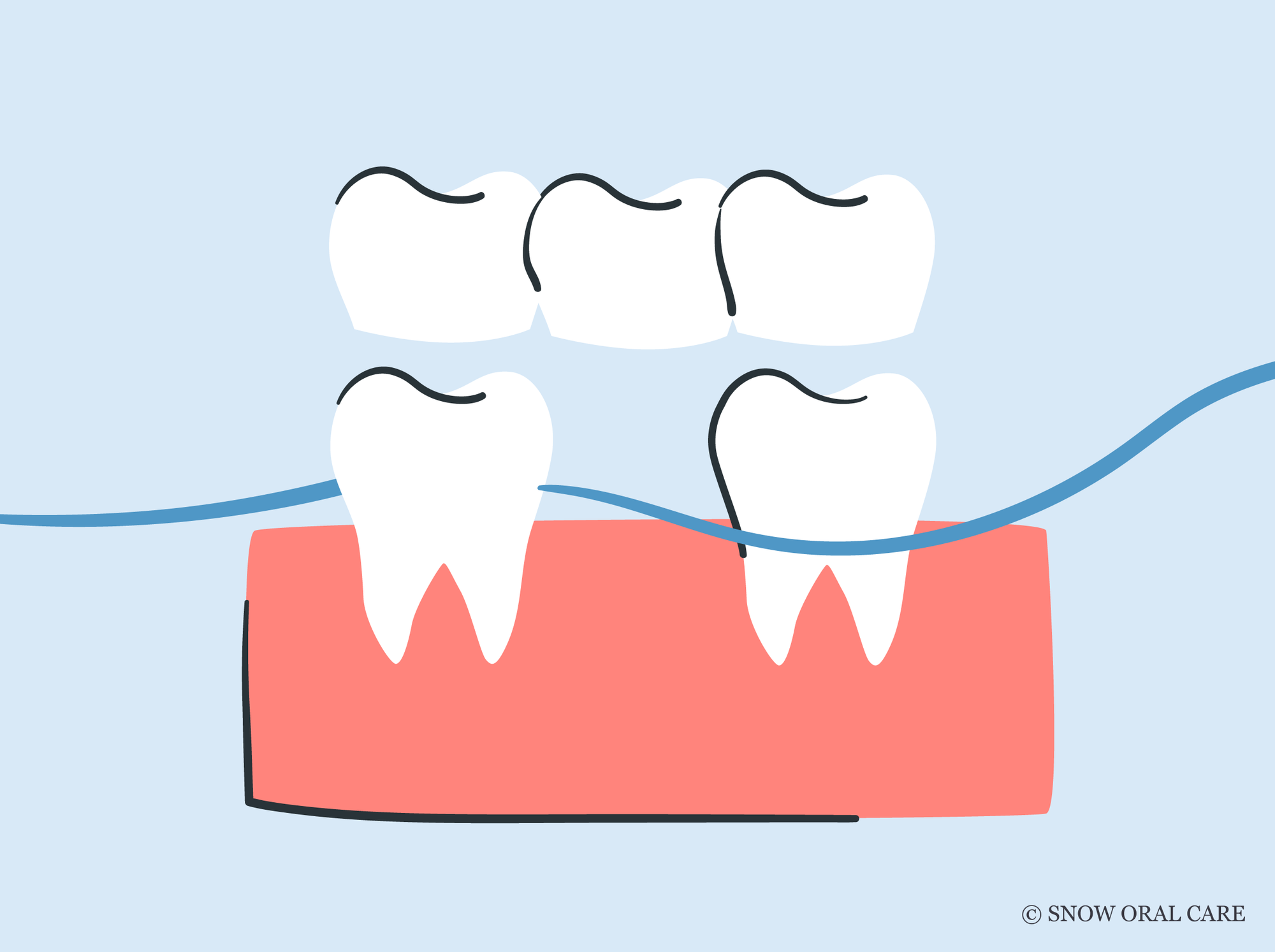 how to floss a bridge