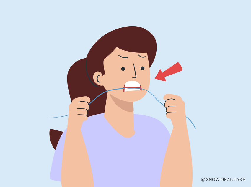 how to floss back teeth