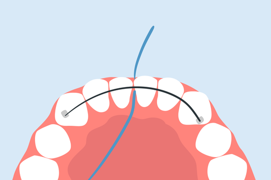 how to floss under permanent retainer without threader