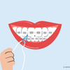 how to floss with braces