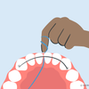 how to floss with permanent retainer