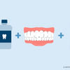 how to get rid of fluoride stains on teeth 