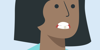 how to get rid of grey stains on teeth 