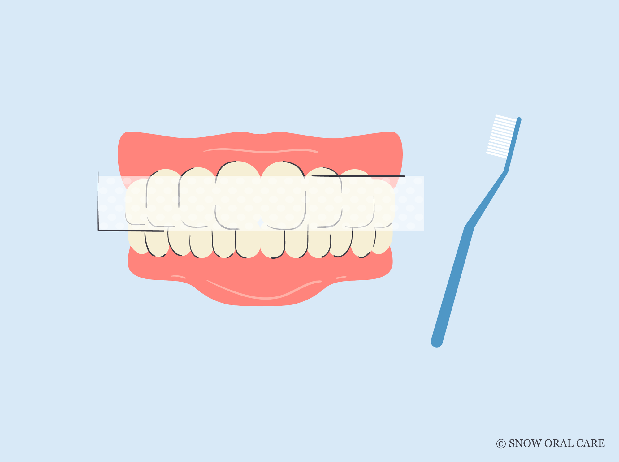how to get rid of yellow teeth after braces 