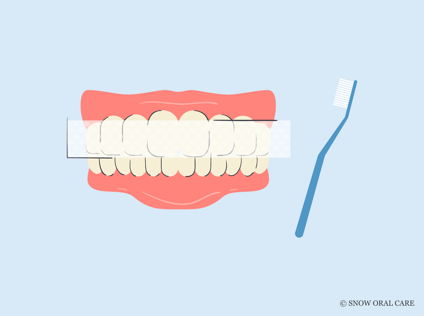 how to get rid of yellow teeth after braces 