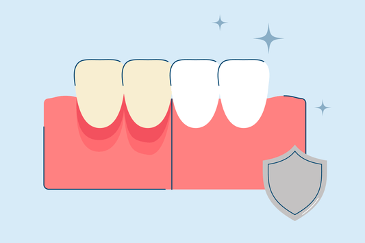 How to Protect Gums During Teeth Whitening