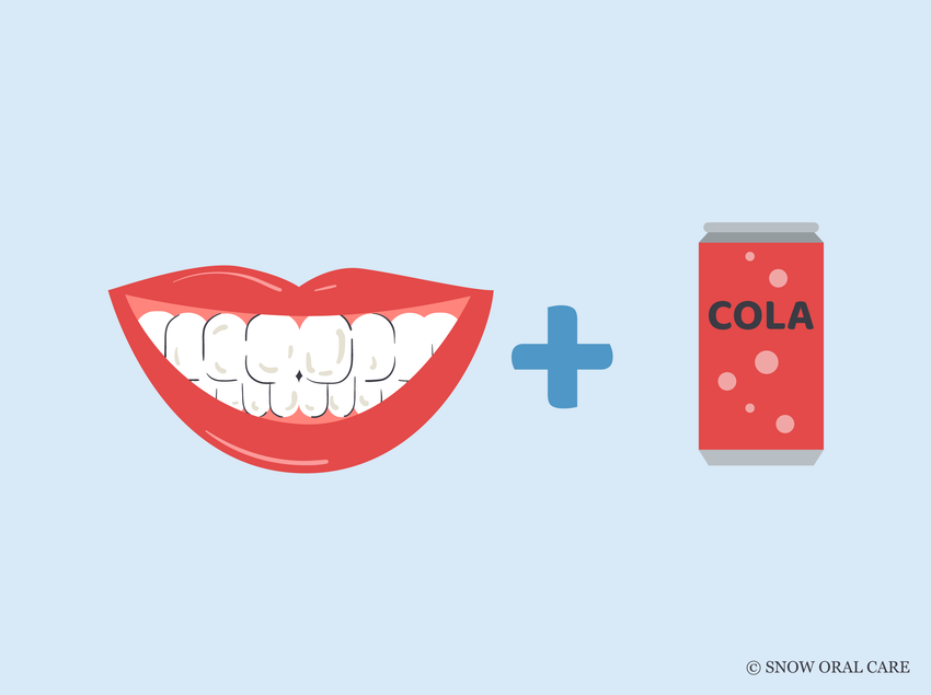 how to remove coke stains from teeth 