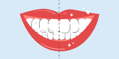 how to remove white spots on teeth at home