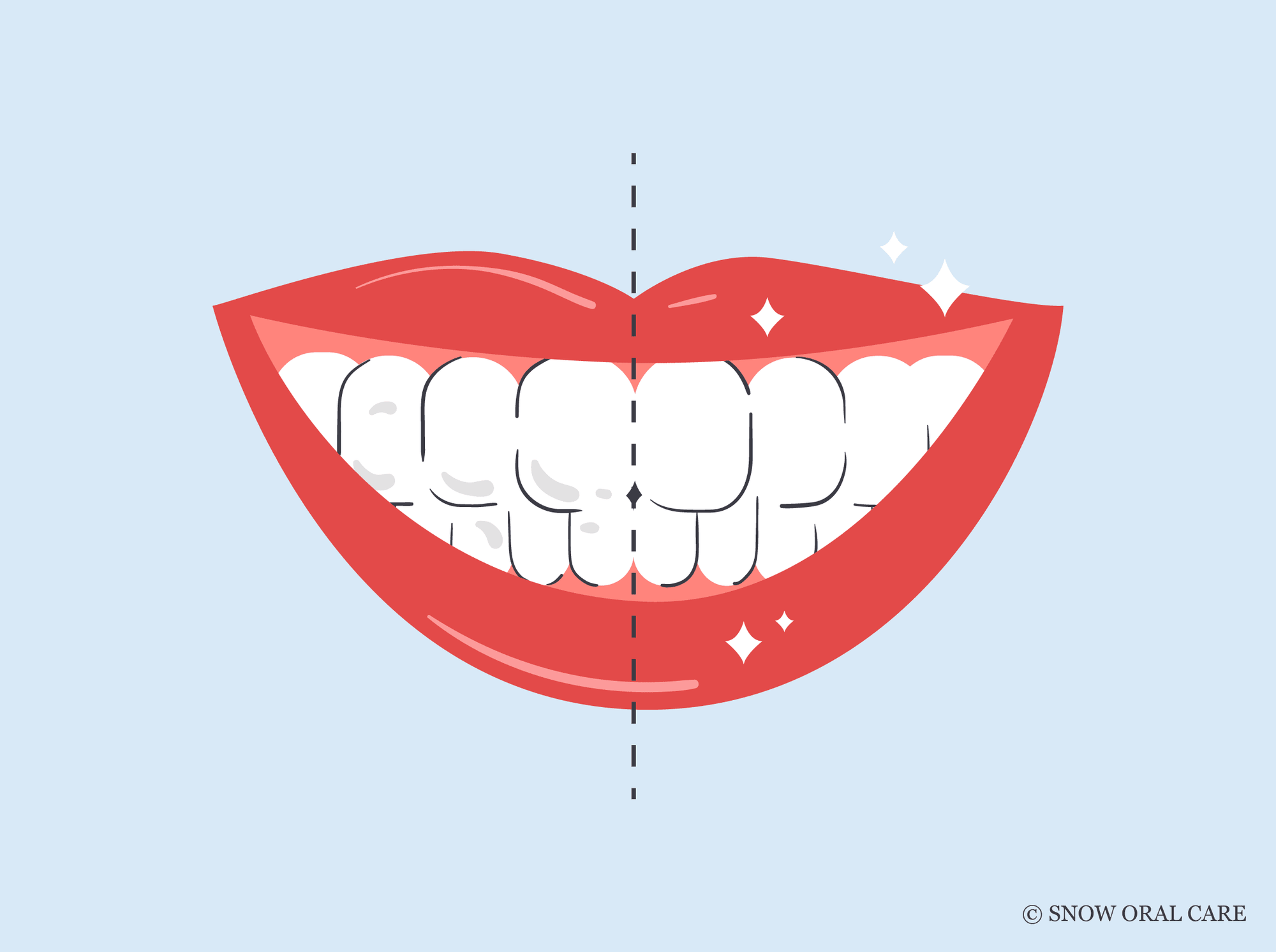 how to remove white spots on teeth at home